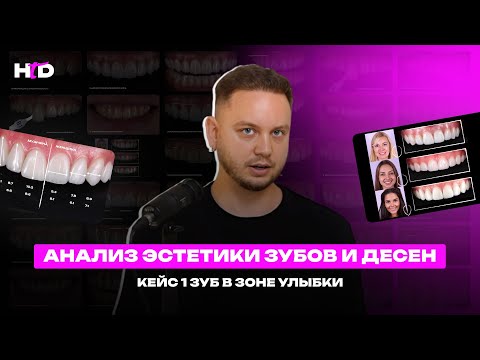 Анализ эстетики зубов и десен