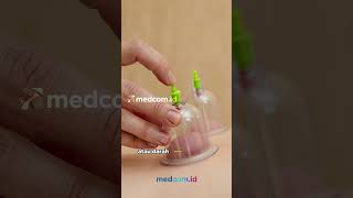 Download lagu Ini 4 Manfaat Terapi Bekam bagi Kesehatan Tubuh mp3 Download lagu Ini 4 Manfaat Terapi Bekam bagi Kesehatan Tubuh mp3