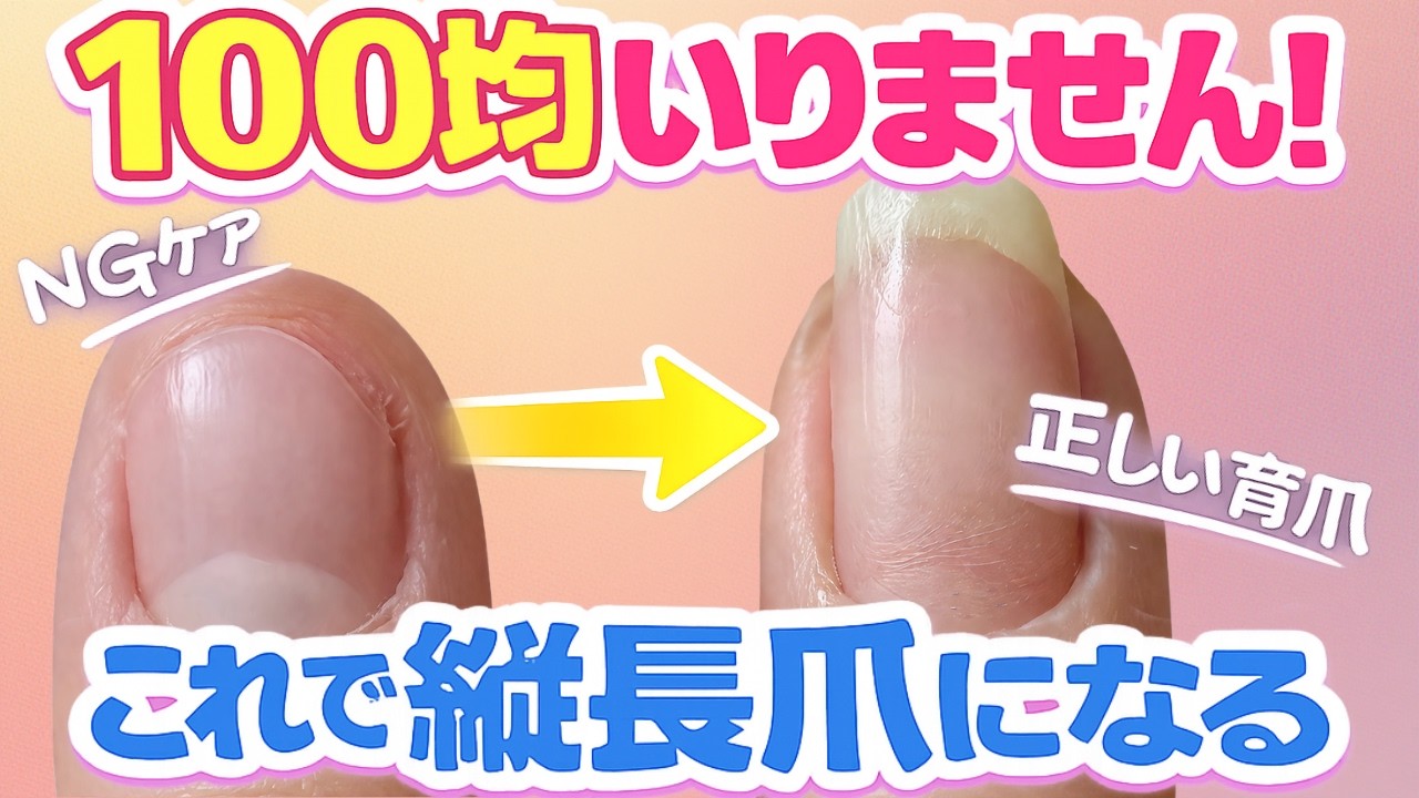 【保存版】タイプ別診断であなたの爪が深爪から抜け出せない理由がわかる！？最速で美しい縦長の爪を手に入れる方法[その１]