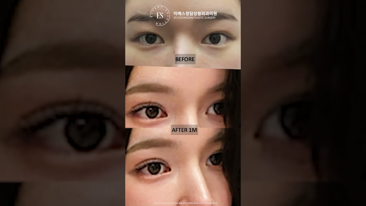 이에스 유튜브