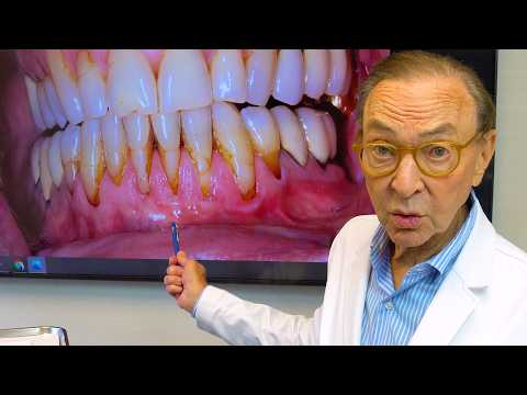 Brushing Your Teeth TOO Hard? Here's What Happens...