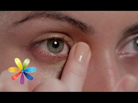 Пигментация кожи у пожилых людей Маска для удаления веснушек