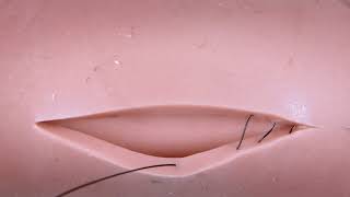 Punto de sutura subdermico