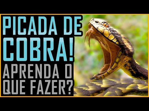 Picada de Cobra - O que Fazer - (Butantan / Venenosa / Peçonhenta)