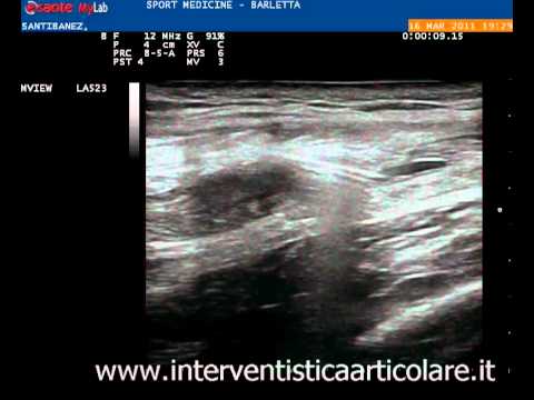 Ro grafia colonna cervicale di cosa si tratta Preparazione per articolazioni e legamenti per gli atleti