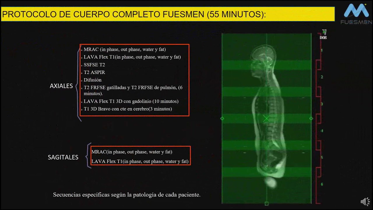 Principales indicaciones y ventajas de PET/MRI en la actualidad - Dr. Gustavo Peña