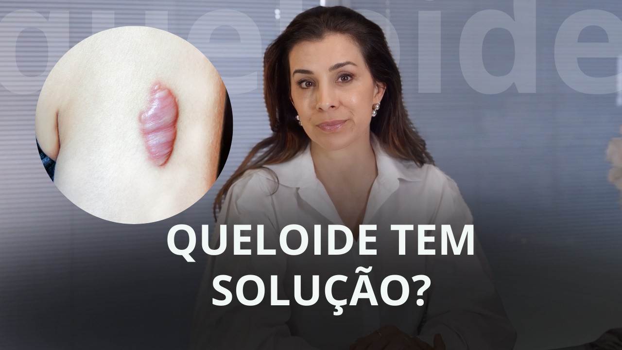 Cicatriz com queloide: O que fazer para tratar?