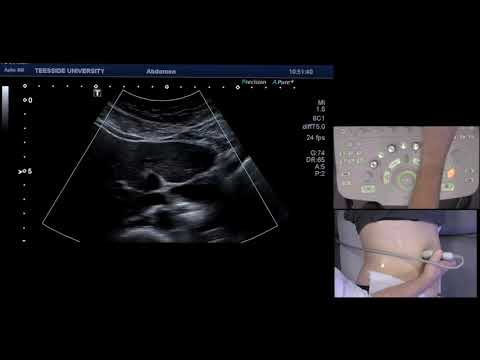 How to scan the gallbladder & CBD