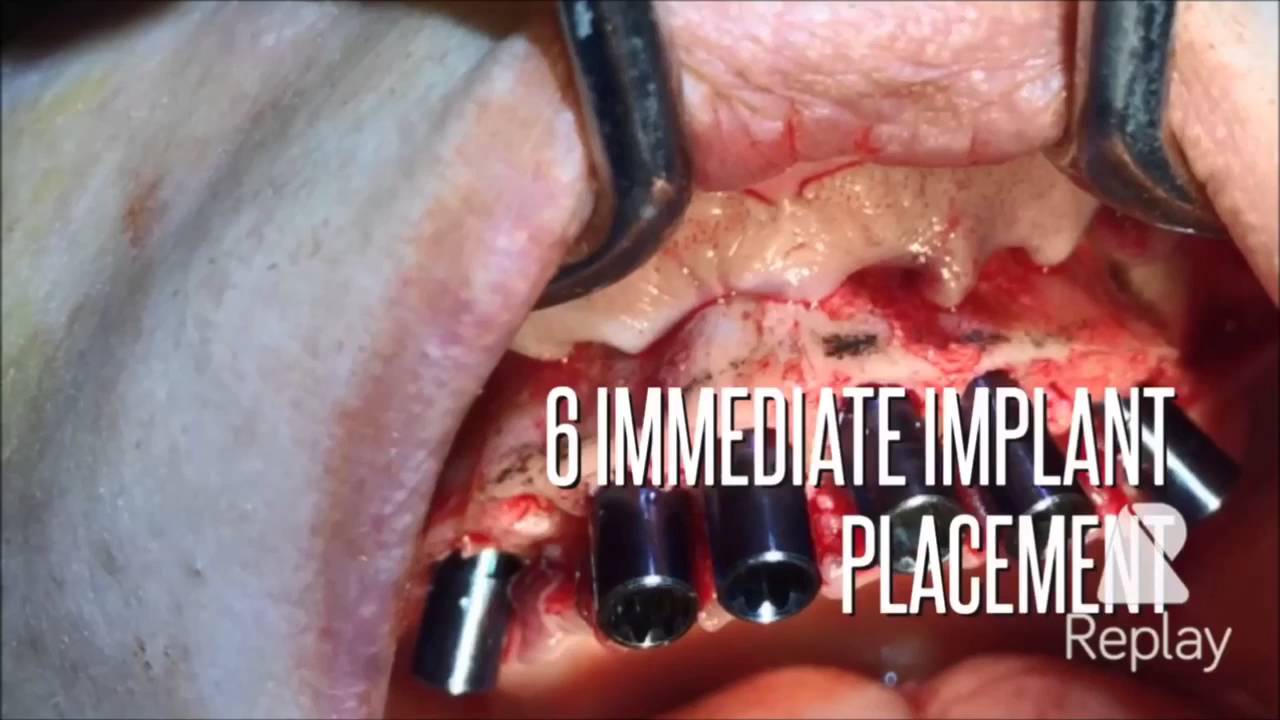 Tolga Gülçiçek-48