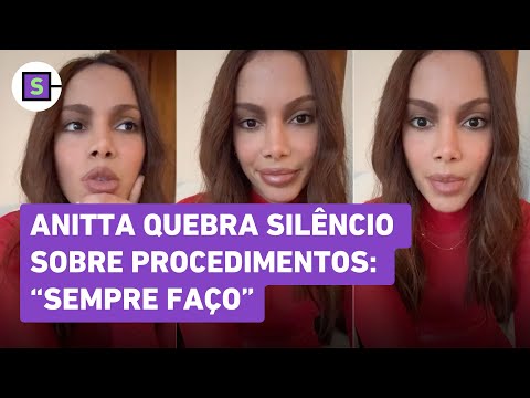 Anitta speaks for the first time about new facial procedure: 'It's my problem'