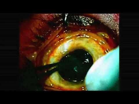 Video thumbnail for Sacraments of Hatred