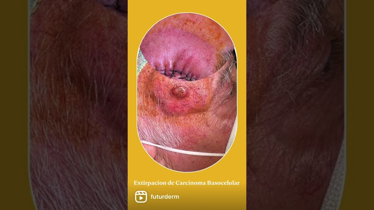 Miguel Angel Flores Terry-14