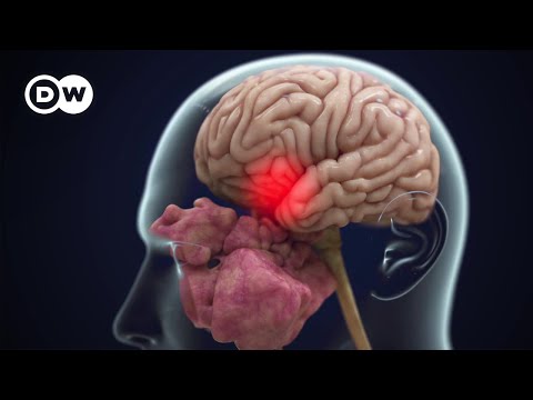 ¿Secuelas a largo plazo?