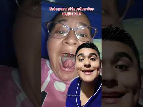 This is what happens when your tonsils are removed #dentist #dentistry #ytshortsmx #shorts