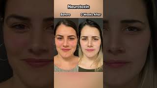 Lampert Md Plastic Surgery