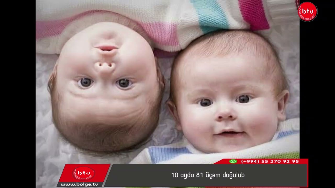 10 ayda 81 üçəm doğulub