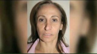 Plastic Surgery Nightmares: How Dr. Tracy Pfeifer corrected a botched breast augmentation