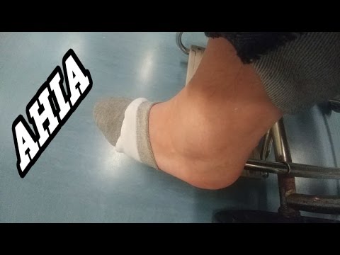 Mal di destra sotto il bordo e dà la schiena e diarrea Mal di schiena Irkutsk