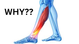 What’s Causing All These Calf Injuries in the NBA This Year? Foot Doctor Explains