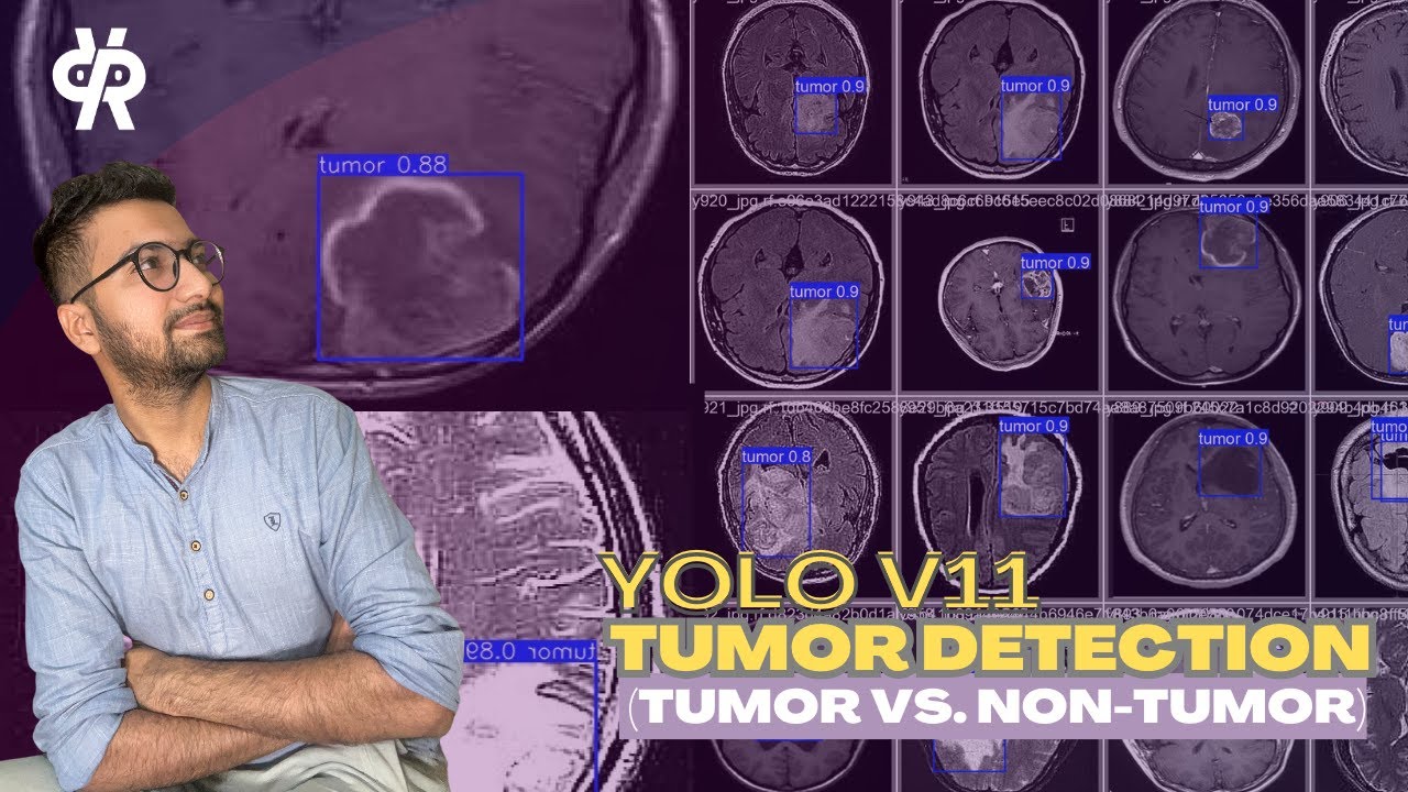 YOLO11 for Tumor Detection: Train on Custom Dataset | Computer Vision