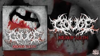 GOUGE - KICKED TEETH [OFFICIAL EP STREAM] (2015) SW EXCLUSIVE