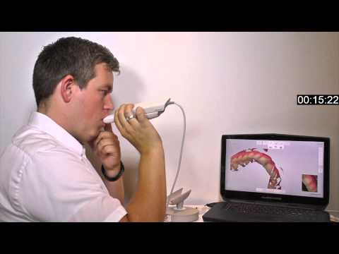 image-How do dental 3D scanners work?