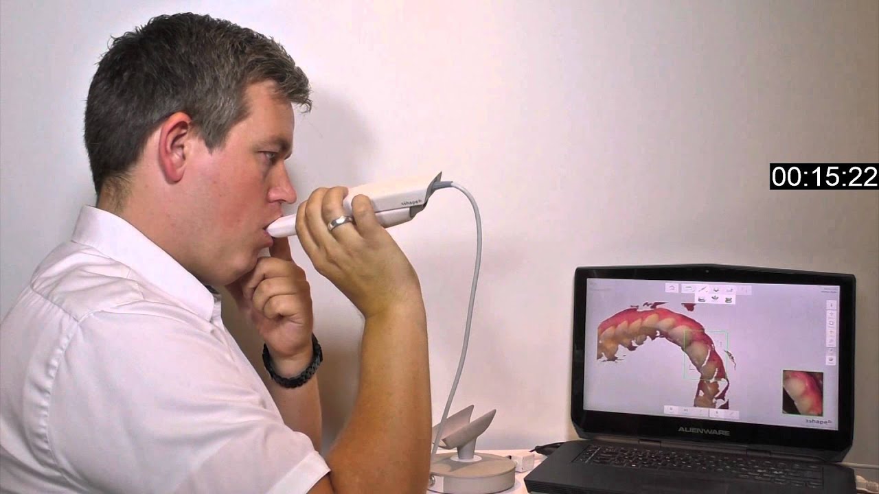 Trios 3 Wired - Máy scan trong miệng kỹ thuật số Trios 3 Wired