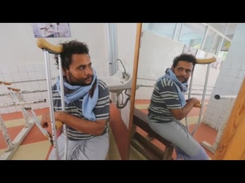 The lost steps of war amputees in Yemen