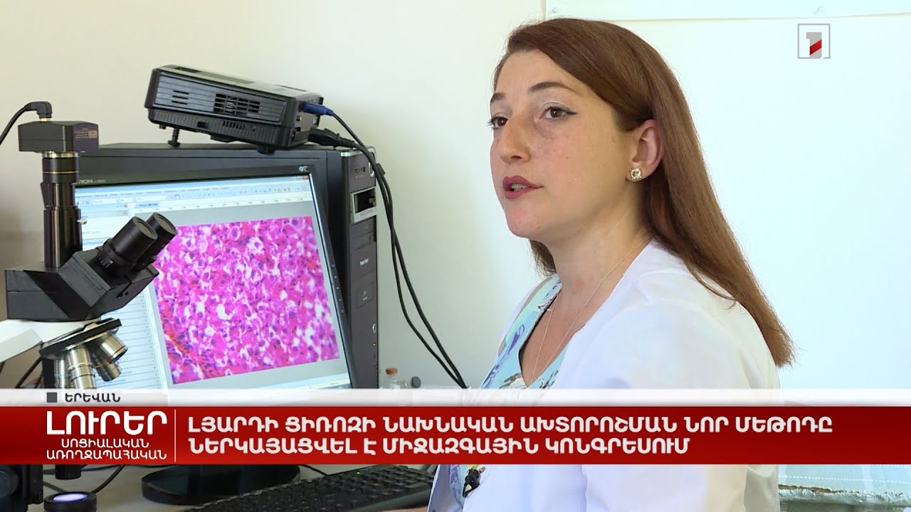 Լյարդի ցիռոզի նախնական ախտորոշման նոր մեթոդը ներկայացվել է միջազգային կոնգրեսում