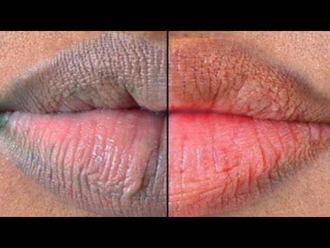 1 week challange for glowing pink lips#lipcare #lipshack