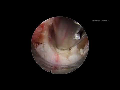 Surgical Video