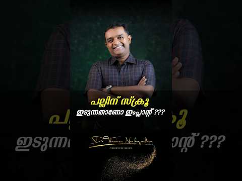 പല്ലിന് സ്ക്രൂ ഇടുന്നതാണോ ഇംപ്ലാന്റ് #dentalvideos #dentalvideos #dentalclinic