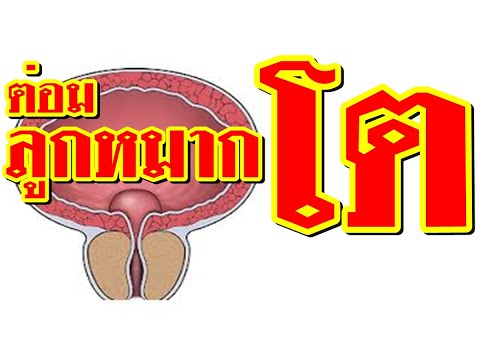 เวทมนตร์และความแข็งแรง อะไรวิธีที่จะเพิ่มสมาชิก