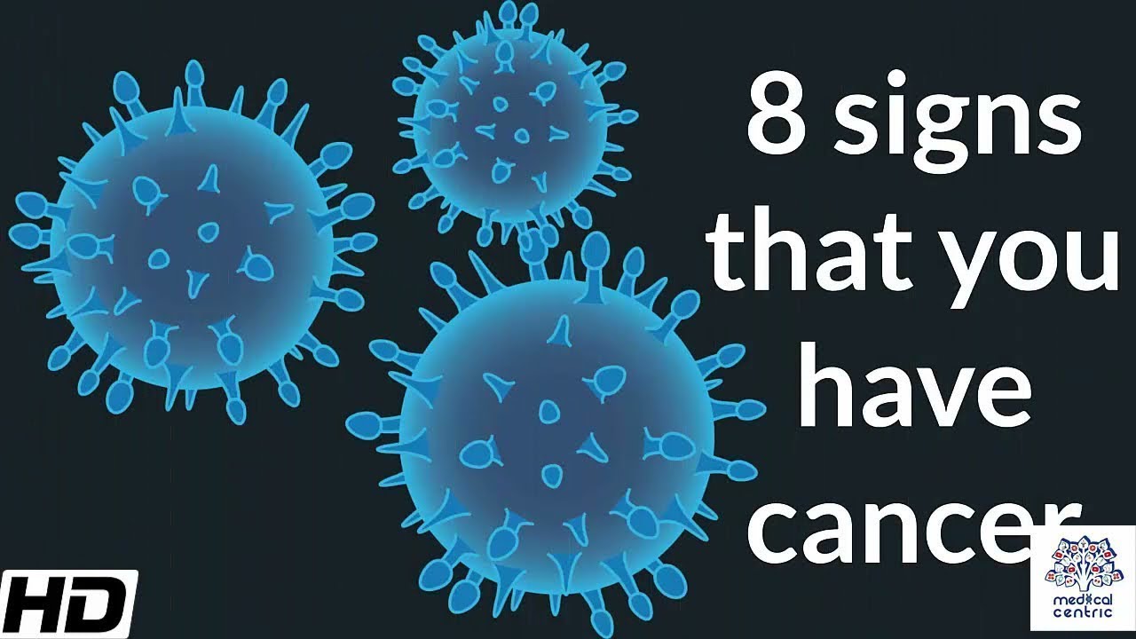8 Signs that You have Cancer