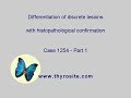 Differentiation Of Discrete Lesions Case 1254 Part 1