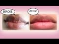 How to Lighten Dark Lips Naturally 