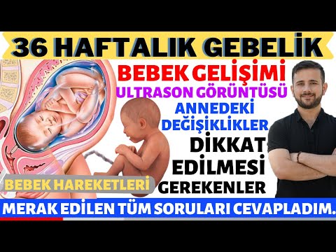 36 Weekly Pregnancy (2020)