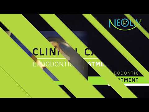 How to use Neolix Neoniti Edm Rotary File Dentbear.com
