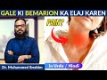 Gale Mein Dard Kharash Mushkil Se Hazam Ilaj Throat Infection Sore Throat Dr M Ibrahim