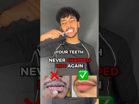 Get Healthy Lips Instantly 😱🩺 Use this vaseline hack to keep your lips smooth! IG @iamomarelka 🤝