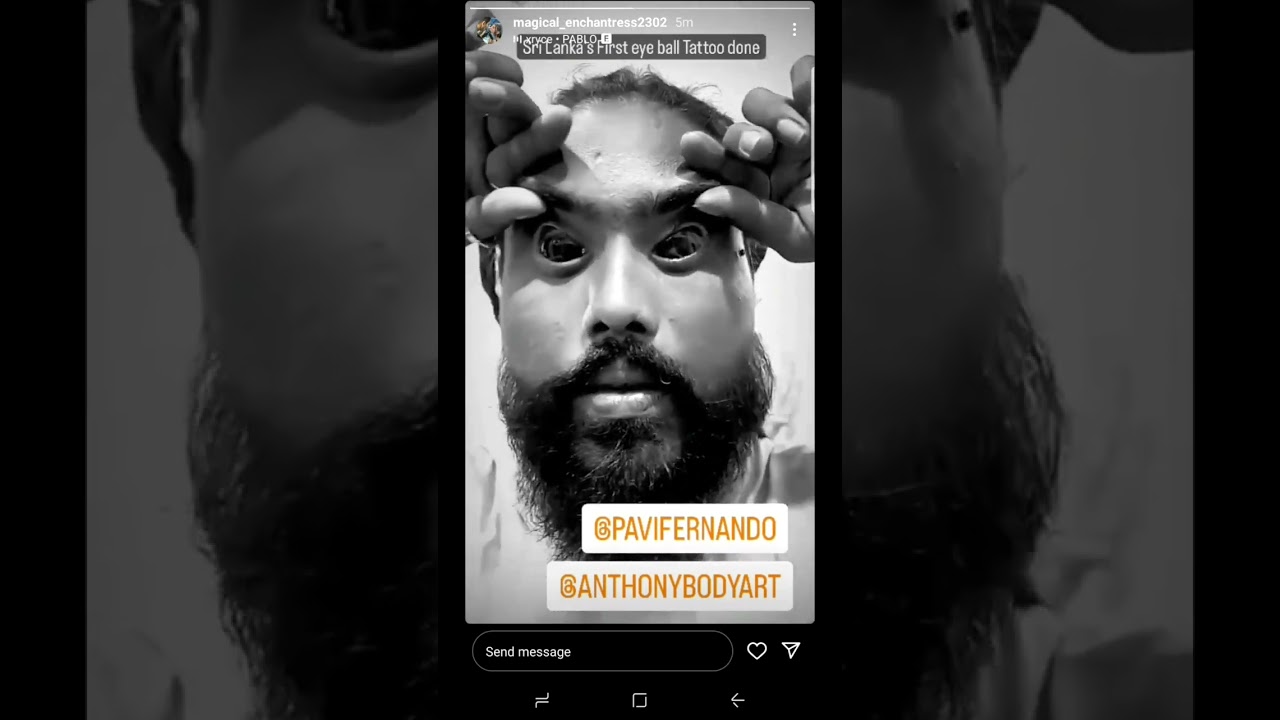 1st Srilanka 🇱🇰 Eyeball Tattoo Done By Antony Body Art