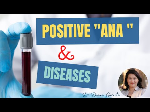 Positive ANA test (antinuclear antibodies) and autoimmune diseases