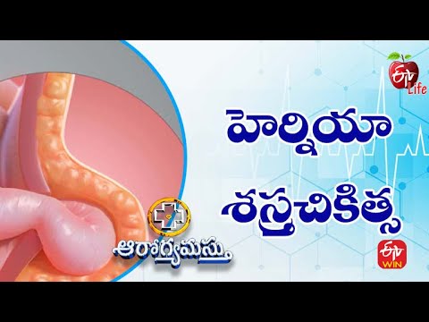 Total Extraperitoneal(TEP)Laparoscopic Inguinal Hernia Repair|Aarogyamastu| 15th Feb 2023 | ETV Life