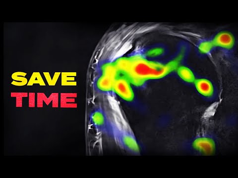 My 7-Second Habit ALL Radiologists Need To Know