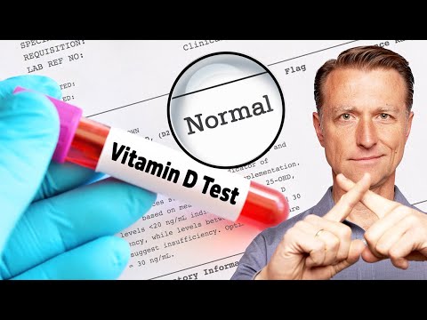 Normal Vitamin D Levels Will NOT Tell the Whole Picture
