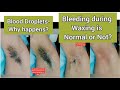 Bleeding Droplet From Hair Follicles Is Normal Or Not Why Happen Full Growth Underarms Waxing