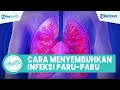 Infeksi Paru Paru Bisa Sembuh Begini Cara Cegah Agar Virus Tak Menyebar Hingga Alami Kerusakan