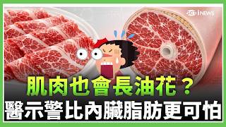 愛吃雪花肉小心自己也長「雪花肌」！醫示警：比內臟脂肪更可怕 恐是糖尿病、肌少症前兆｜三立財經iNEWS