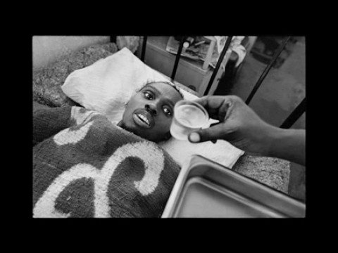 Moving photos of extreme drug-resistant TB