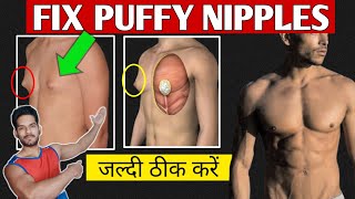 Get rid of puffy nipples 100% | puffy nipples kaise theek kare | get rid of man boobs in hindi